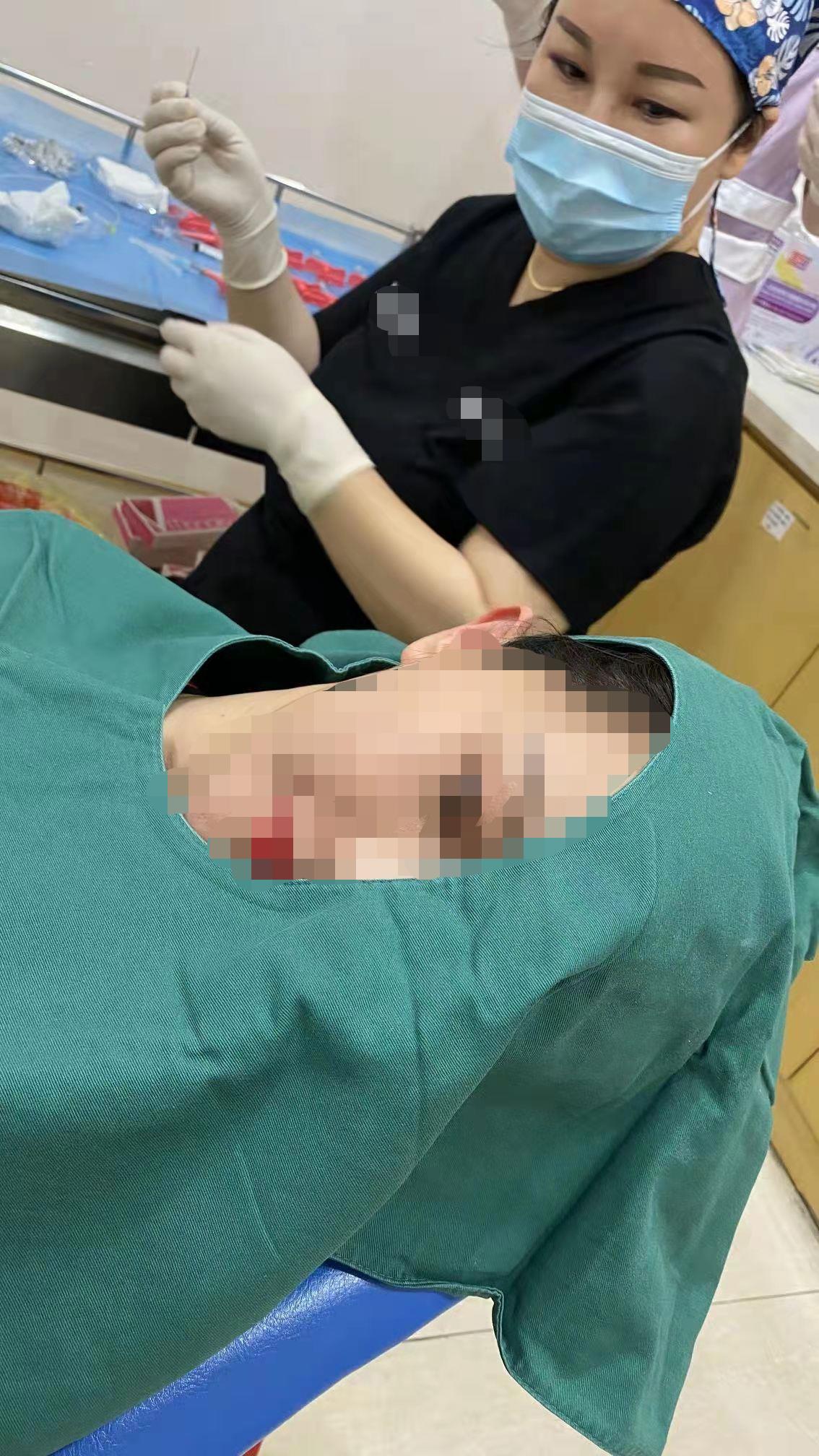 抽脂半年还会有生命危险吗,抽脂会不会很危险呢