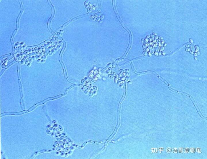 宠物龟常见病诊断和治疗系列1——腐皮