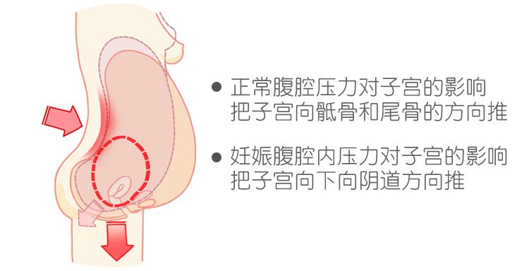 产后漏尿被人耻笑,为什么会产后漏尿