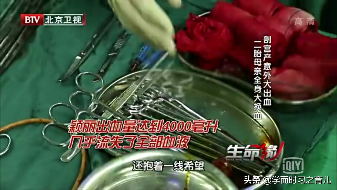 怀孕爸爸需要知道的事,怀孕初期能看出前置胎盘吗