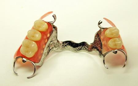 有舒服的活动义齿吗,装一颗活动义齿最舒服的是哪一种