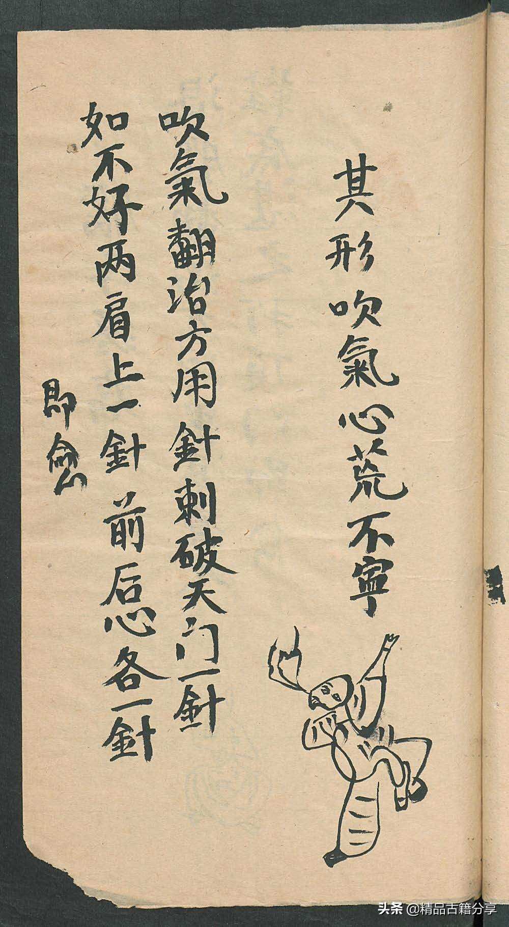 民间中医古籍书籍大全,民间看病书