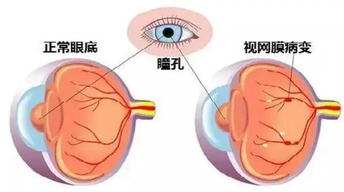 老人视力模糊眼睛失明怎么救治,八旬老人双目失明怎么办