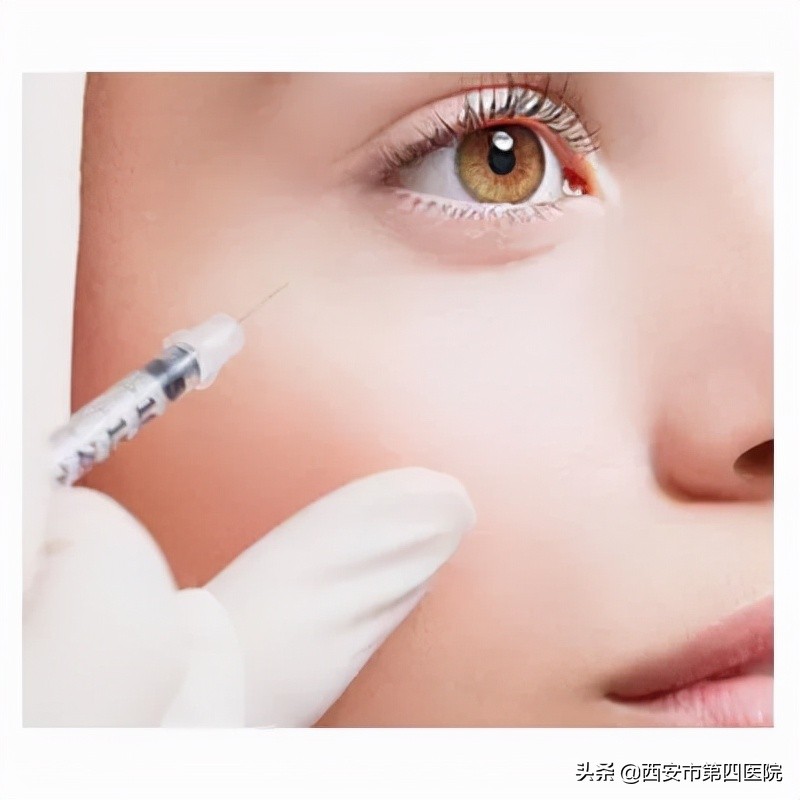 #安心变美课堂##我的安心变美推荐#了解它的真面目，注射去鱼尾纹！
