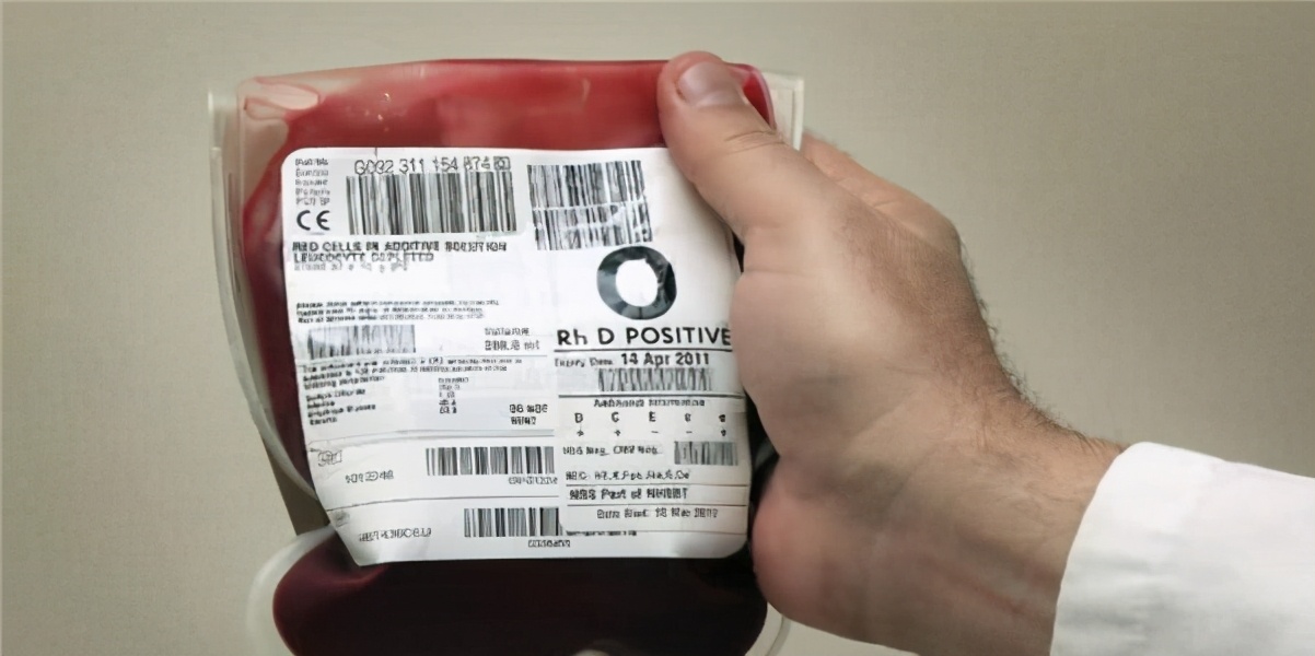 熊猫血精子一般生不了二胎,老婆是熊猫血可以要二胎吗