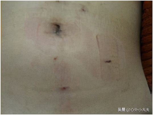 小儿外科常见疾病有哪些,儿童常见的外科疾病有哪些