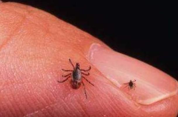 80年代人头上为什么有好多虱子,为什么90年代的人有虱子