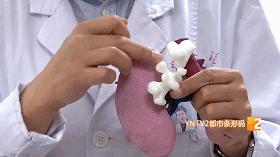 双肾多发结石取出2000多颗,史上最大手术取出肾结石