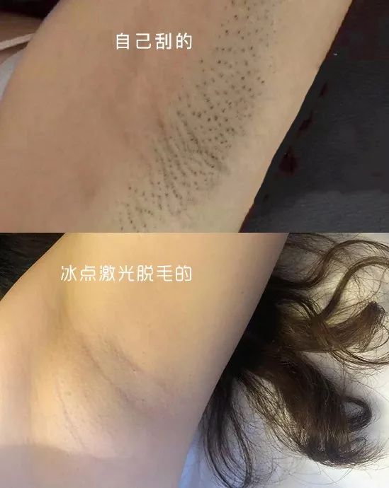 脱毛的方法不花钱,脱毛小技巧立马见效