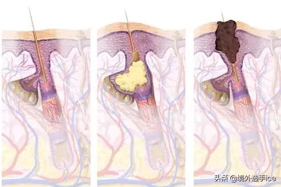 科颜氏亚马逊白泥净致面膜好用吗,科颜氏亚马逊白泥面膜的功效