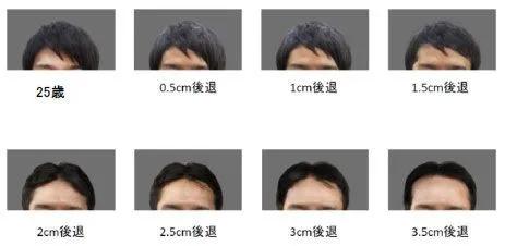 所以秃头的标准是发际线高≥7cm？头秃代表不再是中老年独扛大旗，90后、00后也在积极踊跃加入组织