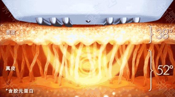 国宝级美容仪李佳琦,李佳琦讲美容仪