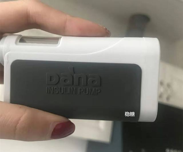 美敦力722胰岛素泵有多少厘米,美敦力胰岛素泵712w与712e的区别