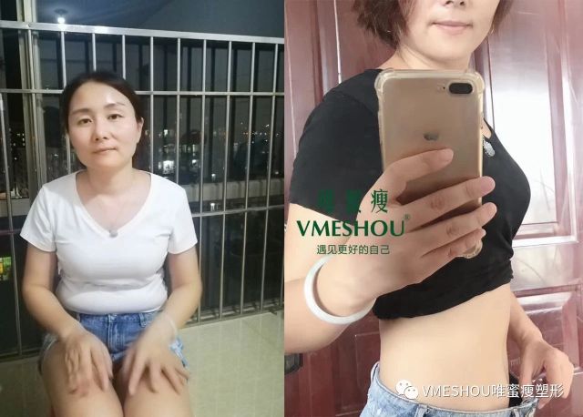 唯蜜瘦1.0真的能减肥吗,唯蜜瘦真的能减肥吗