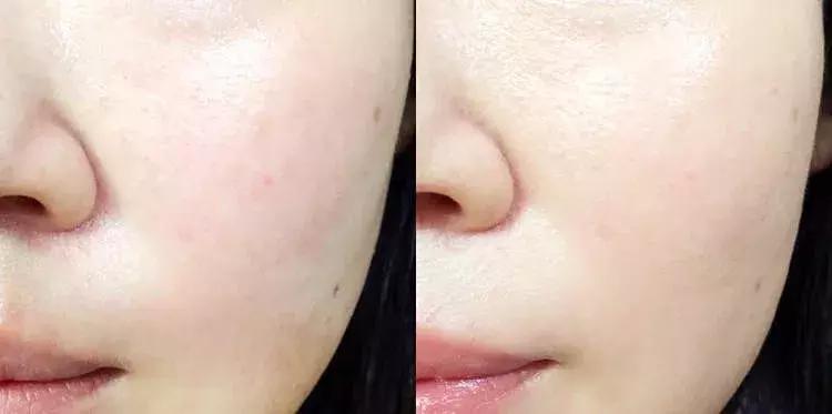 手慢无！最近日本药妆店超级火爆的新品＆限定，已经处于断货边缘