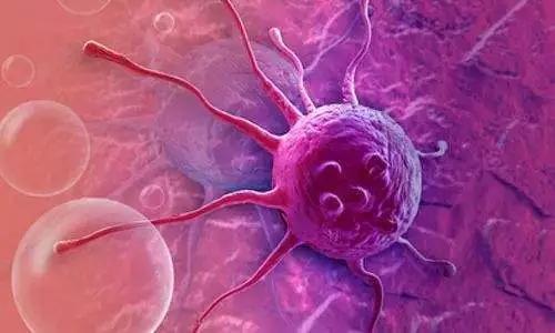 癌细胞扩散到骨头什么感觉,癌细胞扩散到淋巴是什么病