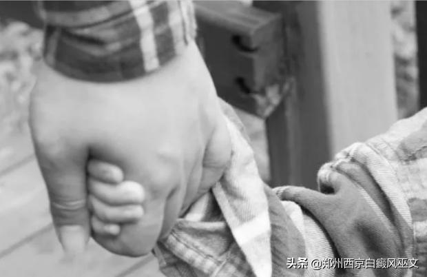 父子都得白癜风,父子都有白癜风