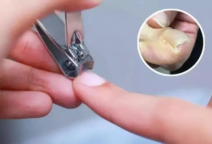 德国造指甲刀,德国制造的工具果然名不虚传