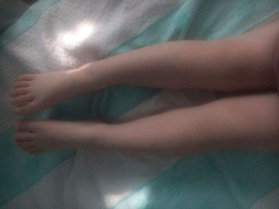 儿童天生长短腿矫正锻炼方法,小孩正常腿型发展