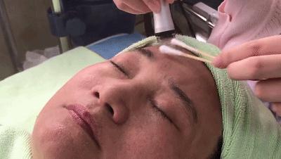 春夏之交，黑头来袭？这才是正确祛除黑头的打开方式！