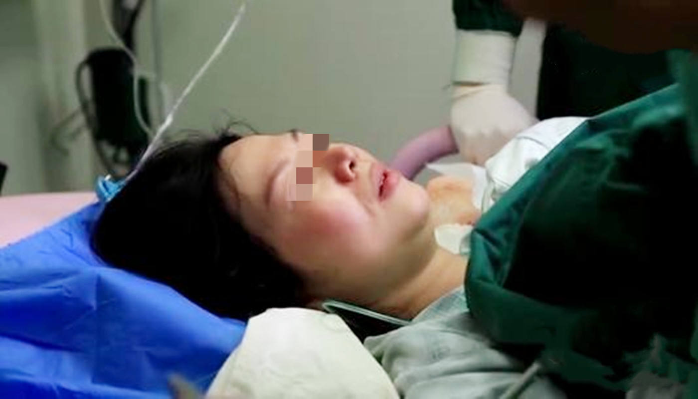 顺产宝宝出生脸有点青怎么回事,分娩脸上出现小红斑怎么办