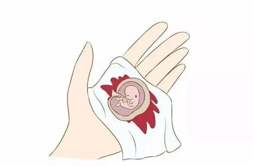 怀孕初期胚胎自己流掉后怎么处理,那些流产后的胎儿去了哪里