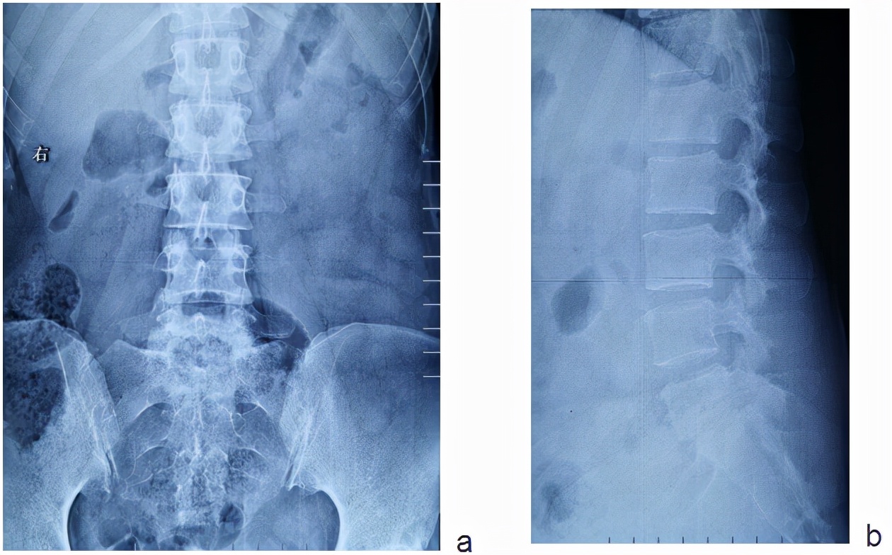 唐都医院脊柱科廖博,脊柱外科医生廖博
