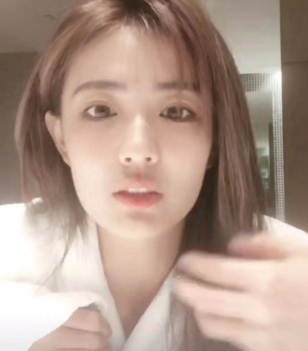 女明星皮肤过敏,女明星过敏发作