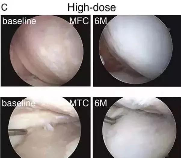 健康科普知识骨关节炎的饮食疗法,健康科普骨关节炎可以预防吗
