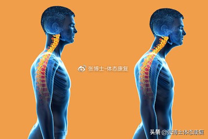 颈部僵硬康复训练方法,如何缓解肩颈肌肉僵硬