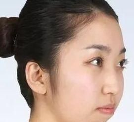 下巴丑如何解决,下巴长得丑怎么用自然方法改善