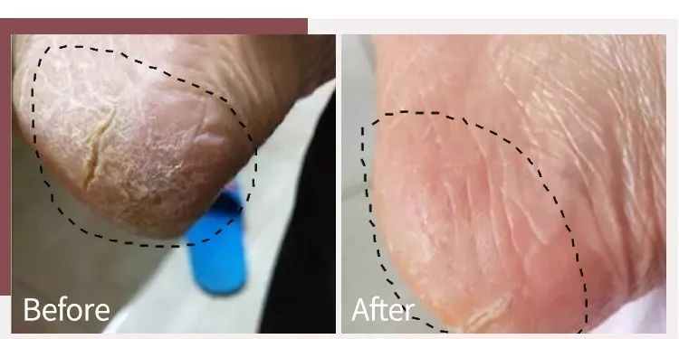 蔡依林护肤视频,蔡依林皮肤特护霜