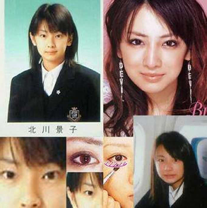 日本整容惊人案例,日本整容是不是最先进