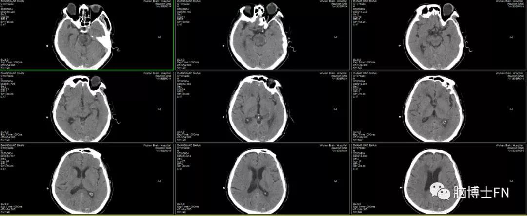 病魔无情人间有爱诗词,病魔无情人间有爱