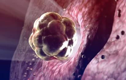 试管婴儿常识知识,准备做试管婴儿你知道流程步骤吗