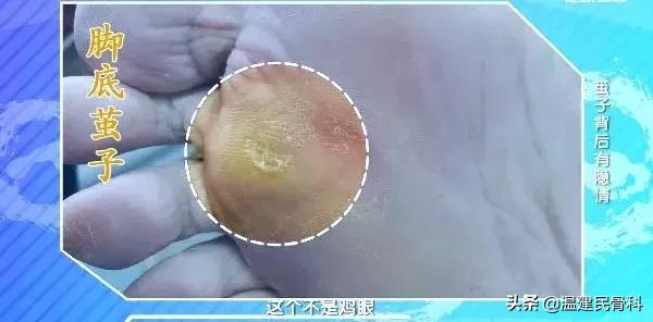 cctv2019年3月25日健康之路节目,cctv10健康之路4月1日回放