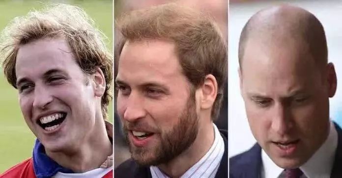 古代头发那么长会脱发吗,古人脱发了怎么办