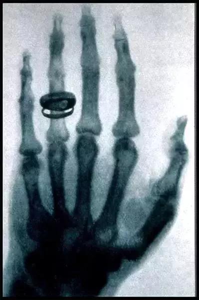 x光b超ct核磁共振区别,收藏这篇就够了