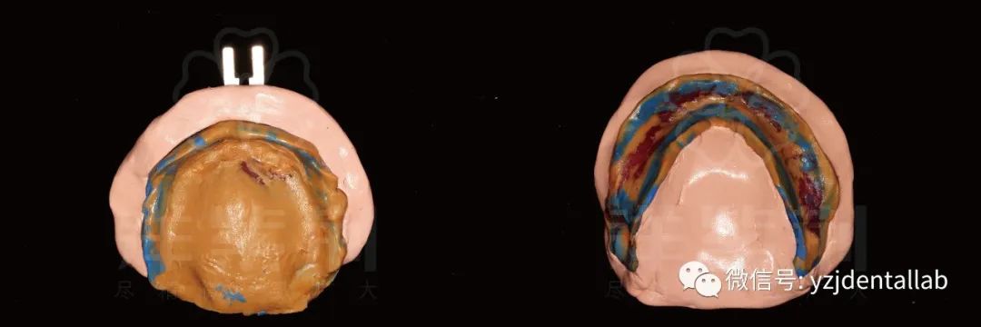病例教学视频,病例分析操作技能