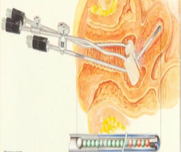 什么是近距离交叉口,什么是近距离用眼时间