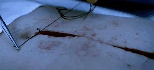 法医秦明删减片段,法医秦明1高清无删减版在线观看