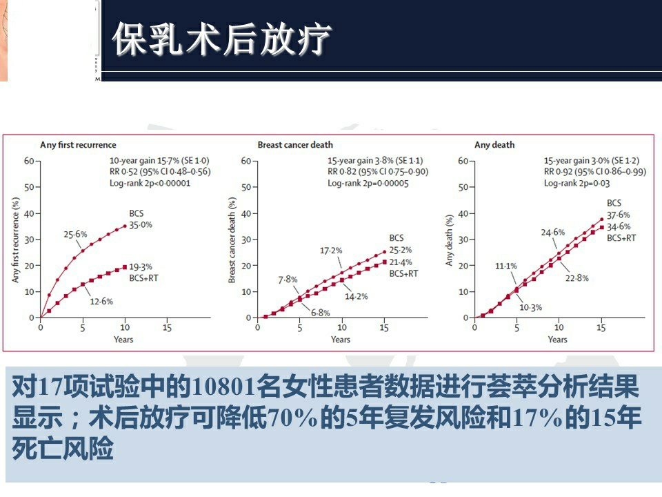 乳腺癌指南2024版,乳腺癌指南有哪几个