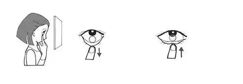 眼科术前宣教,角膜塑形镜住校生怎么戴