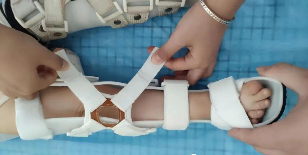 下肢不舒服查什么科,下肢不舒服做什么检查