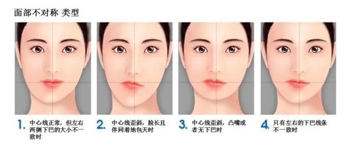 歪脸是什么原因造成的,歪脸怎么治