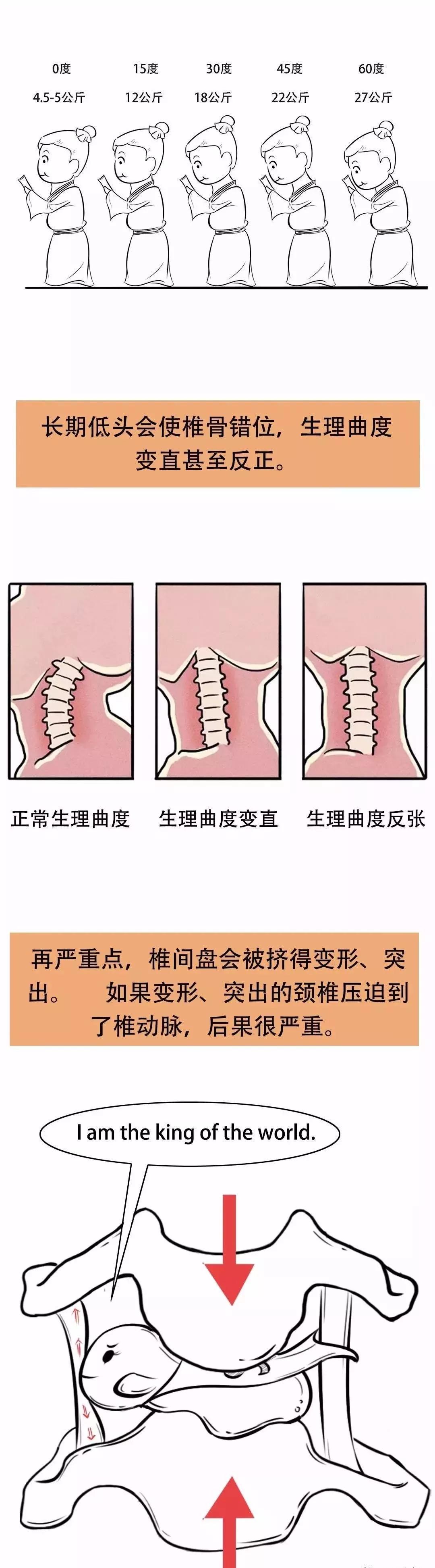 董家骨科治疗颈椎病一次多少钱,董家骨科治颈椎靠谱么