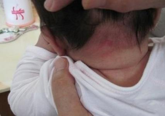 天热,没满月的宝宝满头大汗,宝妈出奇招!网友:不能剃头吗?