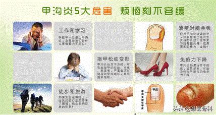 脚趾甲没扎到肉但是很痛怎么回事,脚指甲扎穿肉