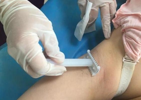 为什么生孩子前要检查身体,生孩子前为什么需要处理毛发