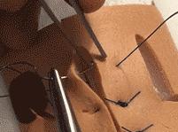 常用的手术缝合方法图,临床常见常用伤口缝合方法